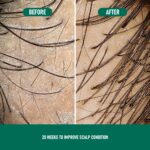 CH004 Minoxidil Anti-Hair Loss Mousse